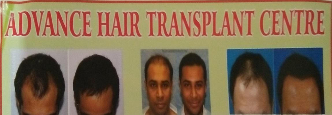 Advance Hair Transplant Centre - Best Hair Transplant Surgeons in  Kankarbagh, Patna.