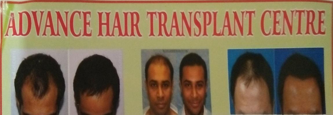Advance Hair Transplant Centre - Best Hair Transplant Surgeons in Kankarbagh, Patna. Advance Hair Transplant Centre - Best Hair Transplant Surgeons in Kankarbagh, Patna.