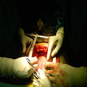 -Heart Hospital Pvt Ltd