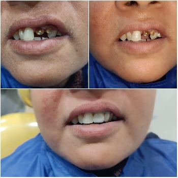 -Muskaan Dental Care